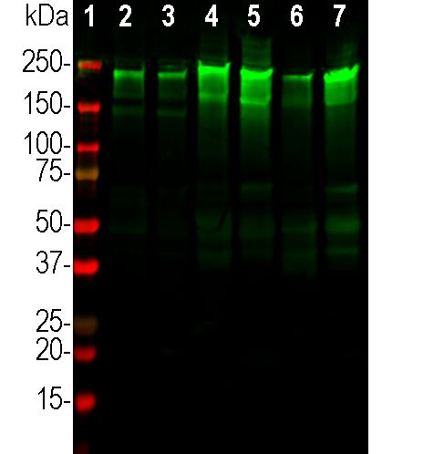 Western Blot