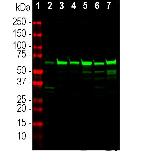 Western Blot