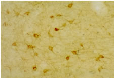 5HT2AR staining of rat cerebral cortex.