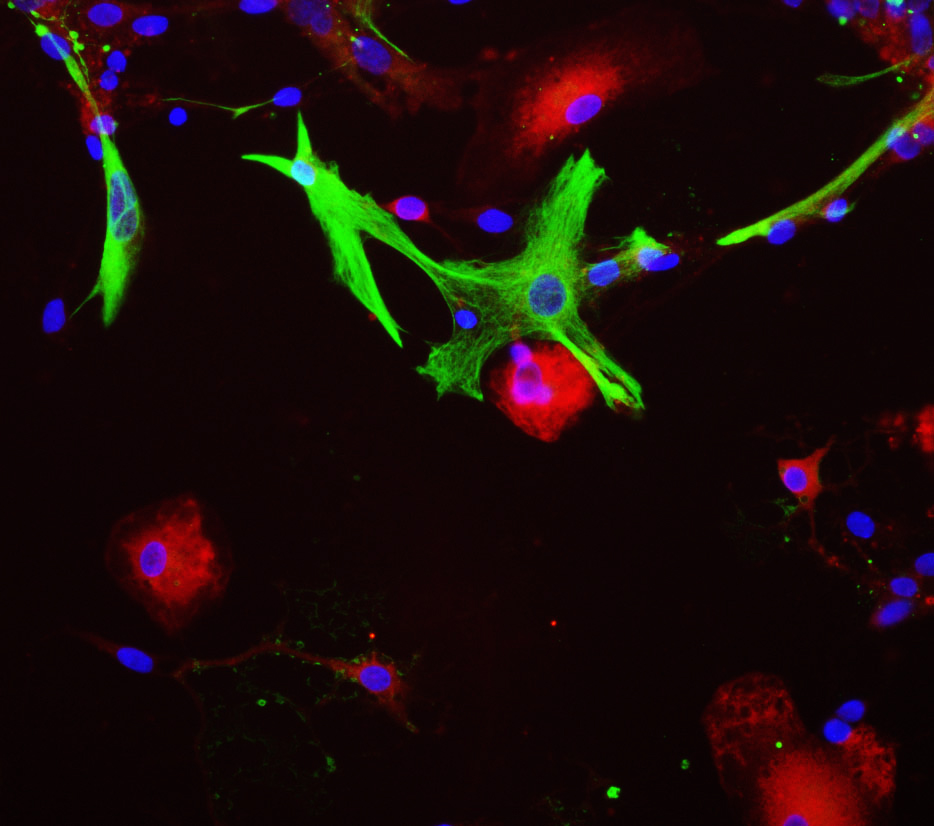 View of mixed neuron/glial cultures stained with MO22156 (red) and our chicken antibody to GFAP antibody (CH22102, green).