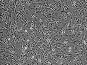 Retinal Pericytes in culture