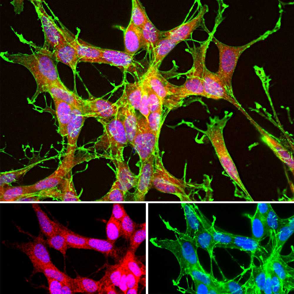 DJ1/Park7 Immunofluorescence