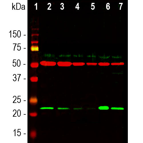 DJ1/Park7 Western Blot