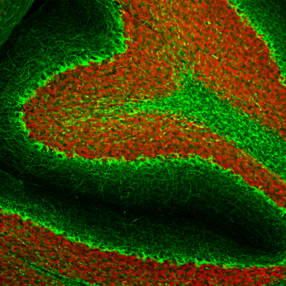 Immunohistochemistry