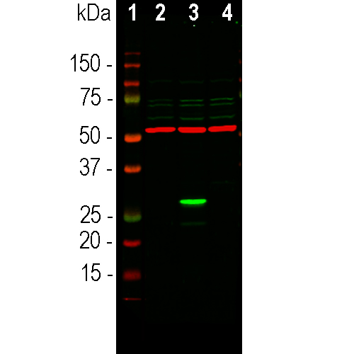 Western Blot