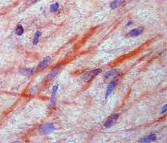 Immunohistochemistry