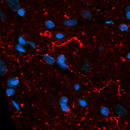 Immunohistochemistry