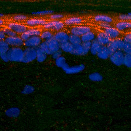 Immunohistochemistry