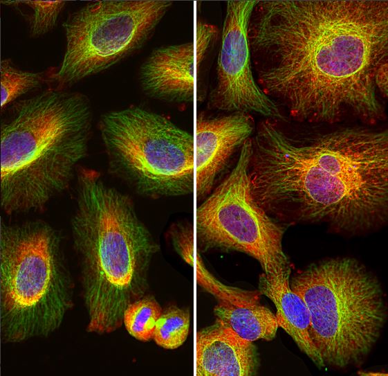 Immunofluorescence