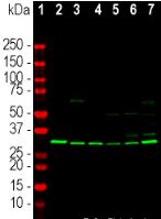 Western Blot