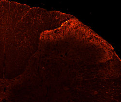 VR1-C staining of rat dorsal horn (dilution 1:100).