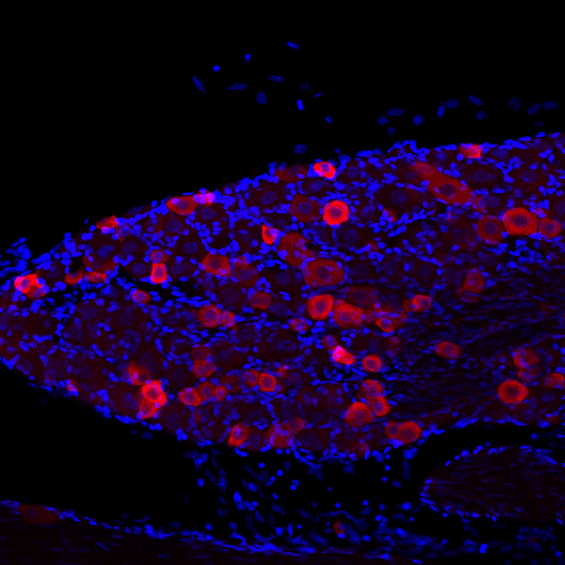 TRPV1 staining of mouse inferior olive using Cy3-conjugated donkey anti-guinea pig secondary antibodies (red color) and DAPI (blue) as a nuclear counterstain.