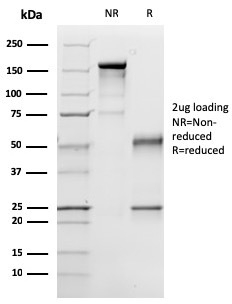 SDS-PAGE Analysis of Purified p57 Mouse Monoclonal Antibody (57P06). Confirmation of Purity and Integrity of Antibody.