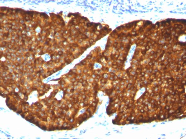 Chromogranin A / CHGA (Neuroendocrine Marker) Antibody