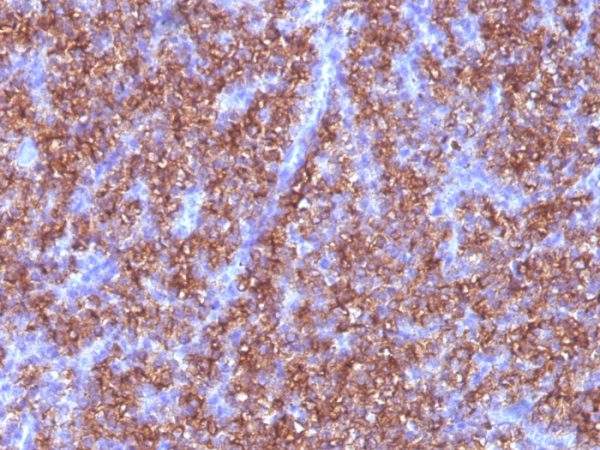 Chromogranin A / CHGA (Neuroendocrine Marker) Antibody - Image 2