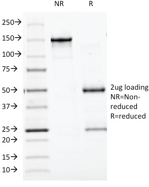 Chromogranin A / CHGA (Neuroendocrine Marker) Antibody - Image 5