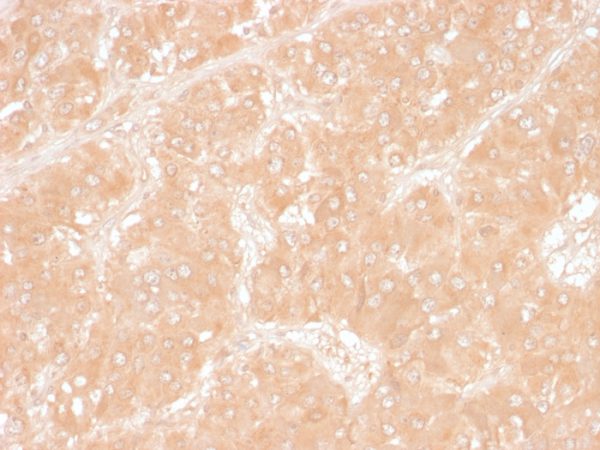 Formalin-fixed, paraffin-embedded human Adrenal stained with Adipophilin Mouse Monoclonal Antibody (ADFP/1366).