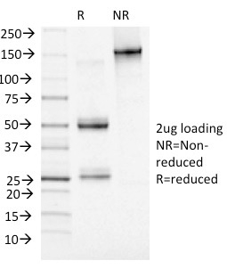 SDS-PAGE Analysis of Purified Adipophilin Mouse Monoclonal Antibody (ADFP/1493). Confirmation of Integrity and Purity of Antibody.