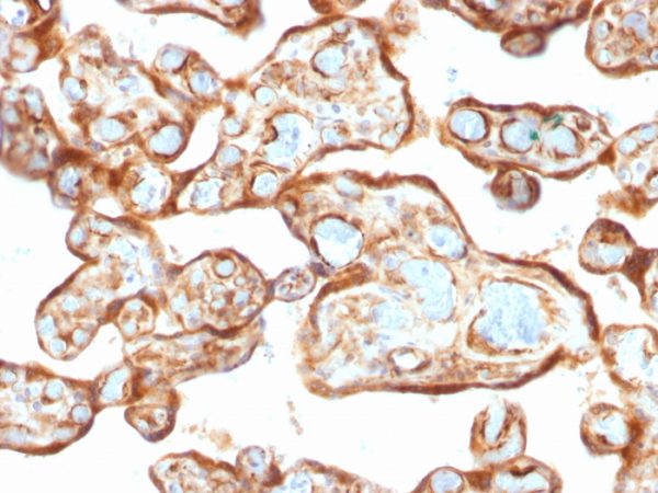 Formalin-fixed, paraffin-embedded human Placenta stained with Thymidine Phosphorylase / PD-ECGF Monoclonal Antibody (P-GF.44C).