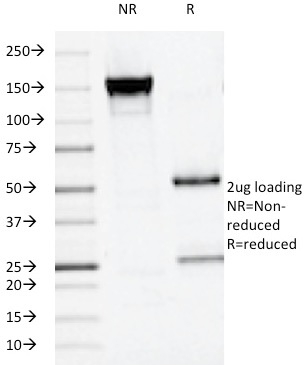 SDS-PAGE Analysis of Purified PLAP Mouse Monoclonal Antibody (ALPP/516). Confirmation of Integrity and Purity of Antibody.