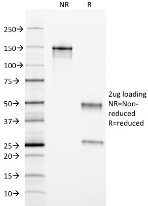 SDS-PAGE Analysis of Purified Ferritin, Light Chain Mouse Monoclonal Antibody (FTL/1389). Confirmation of Integrity and Purity of Antibody