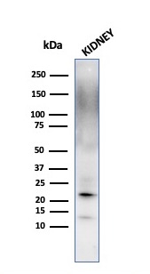 Western Blot Analysis of kidney tissue lysate using Ferritin, Light Chain Monoclonal Antibody (FTL/1389).