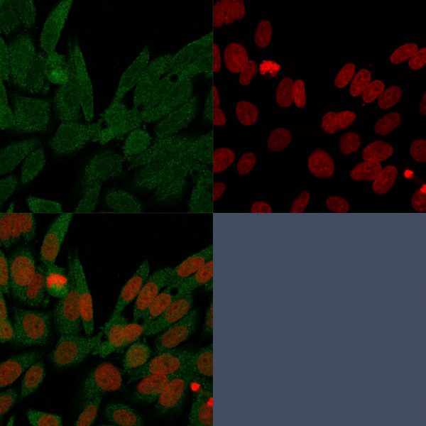 IDH1 (Isocitrate Dehydrogenase) Antibody - Image 3