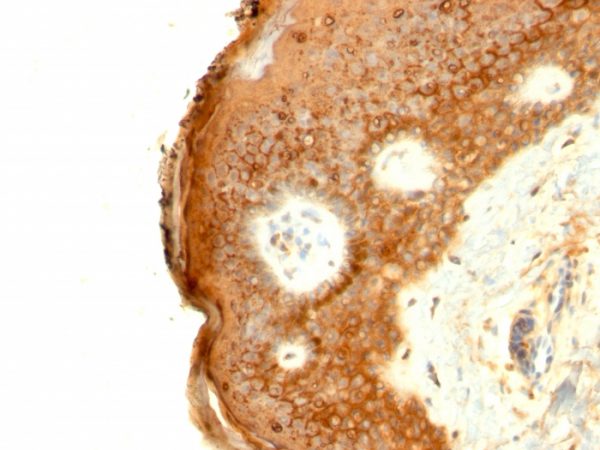 Formalin-fixed, paraffin-embedded human Skin stained with Involucrin Mouse Monoclonal Antibody (SPM259).