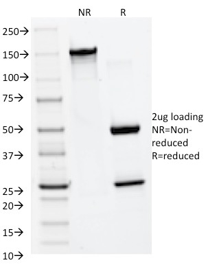 MMP2 / Collagenase Type IV A (Tumor Metastasis Marker) Antibody - Image 2