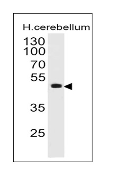 PAX6 (Stem Cell Marker) Antibody