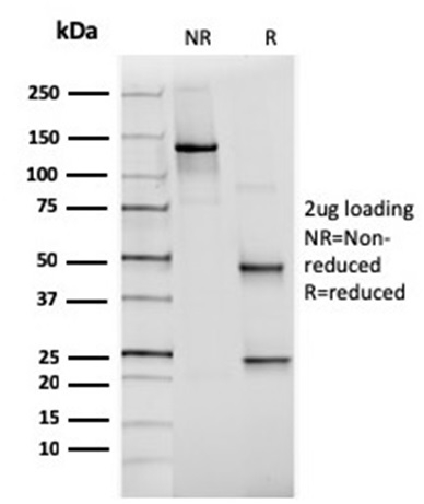 PAX6 (Stem Cell Marker) Antibody - Image 2