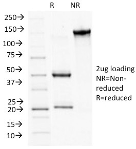 SDS-PAGE Analysis of Purified CD56 Monoclonal Antibody (NCAM1/784). Confirmation of Integrity and Purity of Antibody