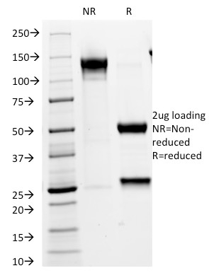 SDS-PAGE Analysis of Purified VLDL-Receptor Mouse Monoclonal Antibody (VLDLR/1337). Confirmation of Purity and Integrity of Antibody.