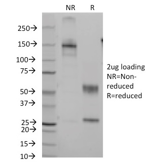 SDS-PAGE Analysis of Purified CD7 Mouse Monoclonal Antibody (Clone B-F12). Confirmation of Integrity and Purity of Antibody.