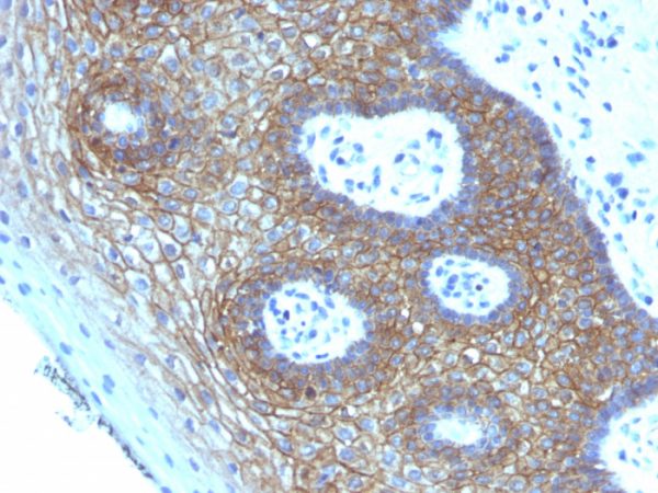 CD44v4 (Marker of Tumor Metastasis) Antibody