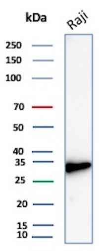 CD20 Antibody in Western Blot (WB)