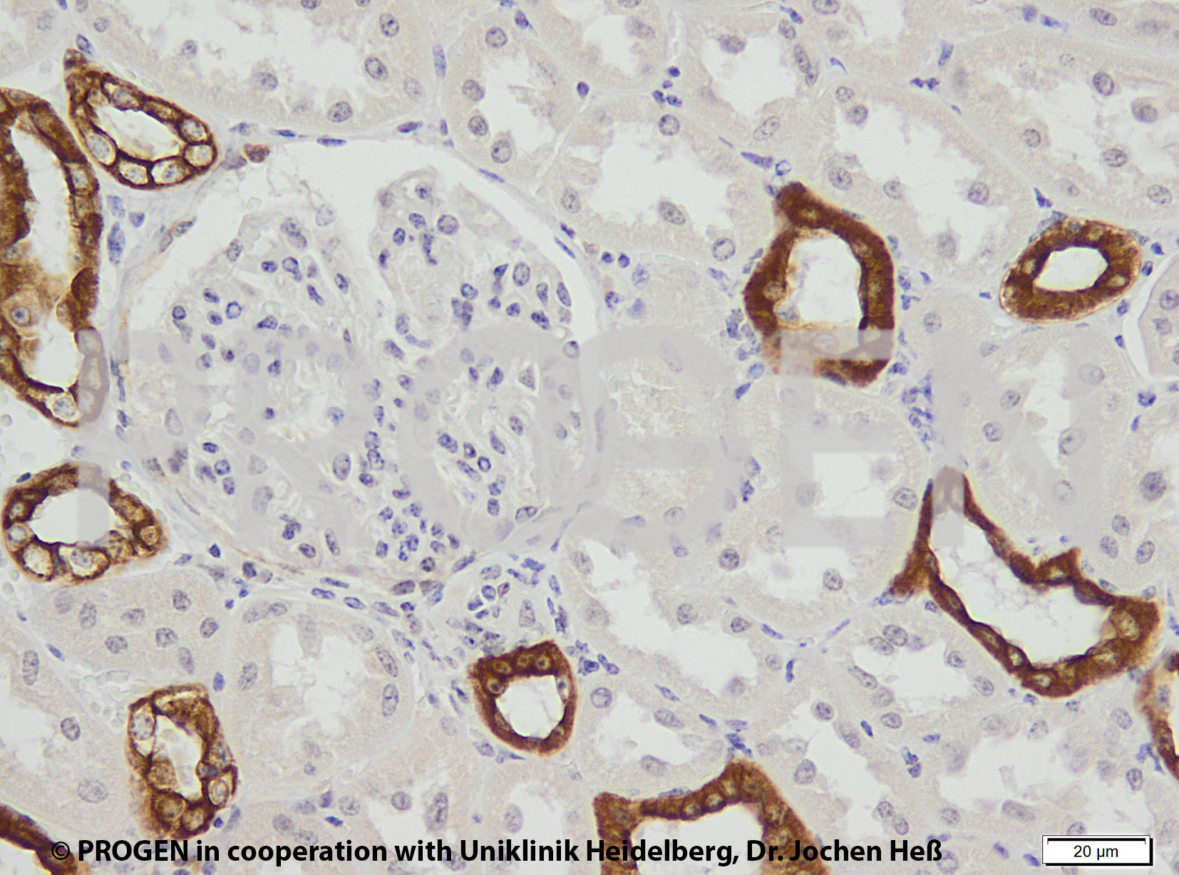 anti-Keratin K18 Multiepitope Cocktail mouse monoclonal, Ks18.04 + 18.27 + 18.5 + 9B1 + 18.174, supernatant