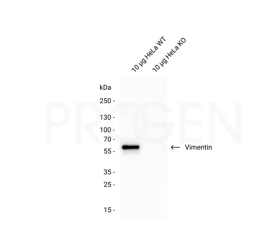 anti-Vimentin guinea pig polyclonal, serum