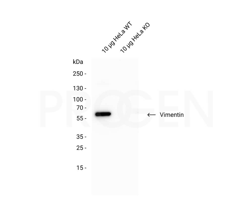 anti-Vimentin mouse monoclonal, VIM 3B4, lyophilized, purified