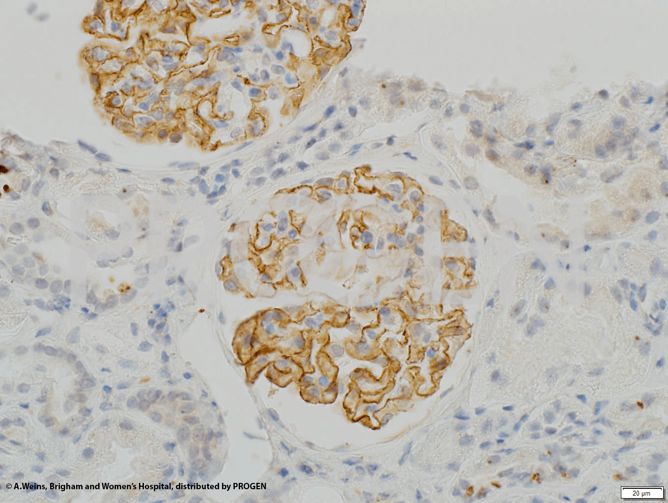 anti-Synaptopodin/SYNPO (C-terminus) guinea pig polyclonal, serum