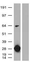 Chicken Polyclonal turboGFP Antibody