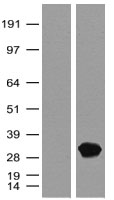 Goat Polyclonal turboGFP Antibody