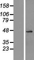 OGG1 (NM_016821) Human Over-expression Lysate