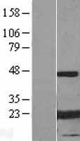 Alpha B Crystallin (CRYAB) (NM_001885) Human Over-expression Lysate