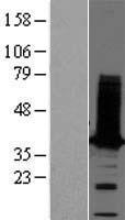 Tropomyosin 2 (TPM2) (NM_003289) Human Over-expression Lysate