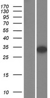 AUTS2 (NM_001127232) Human Over-expression Lysate