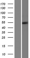 ALDH5A1 (NM_170740) Human Over-expression Lysate