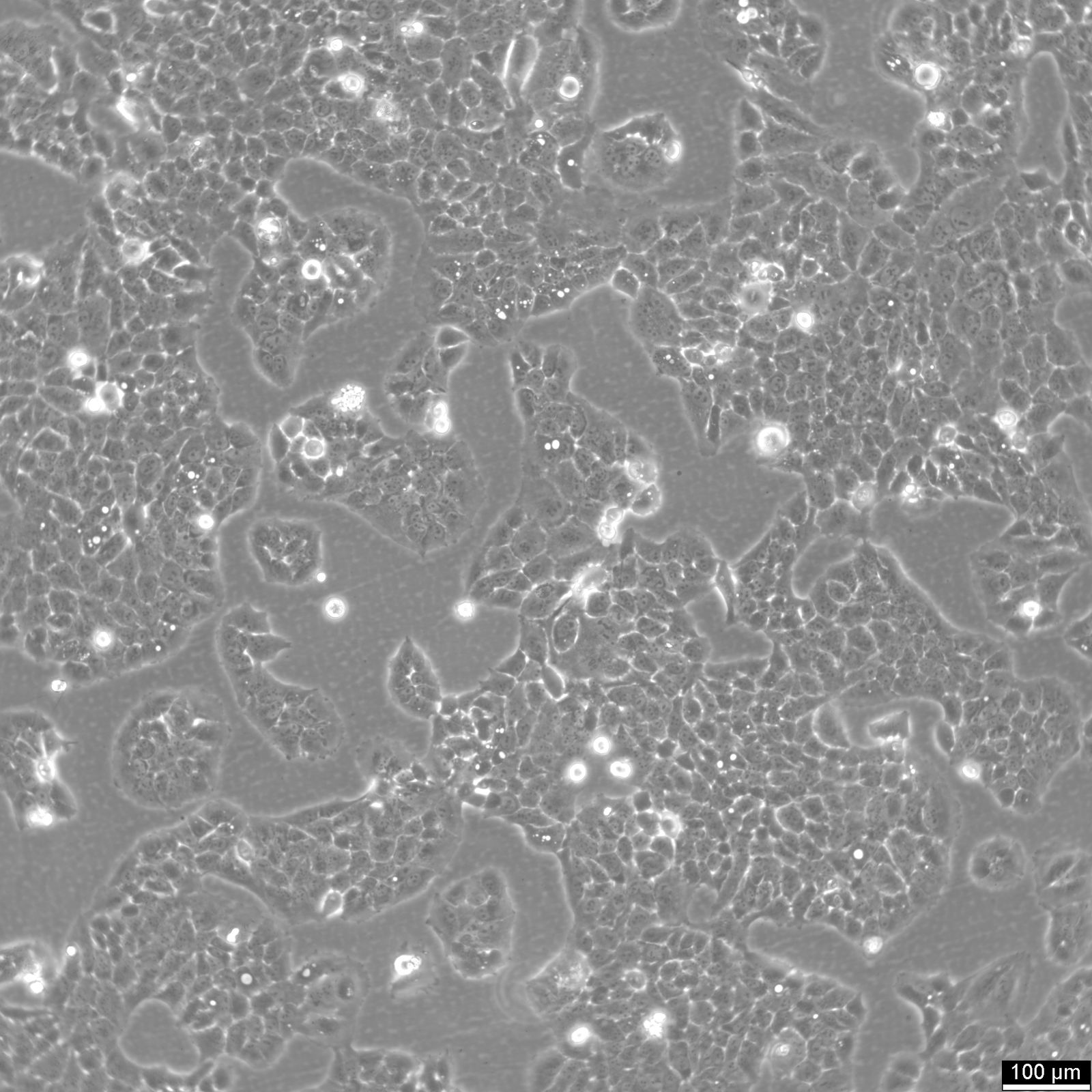 MS751 Cells