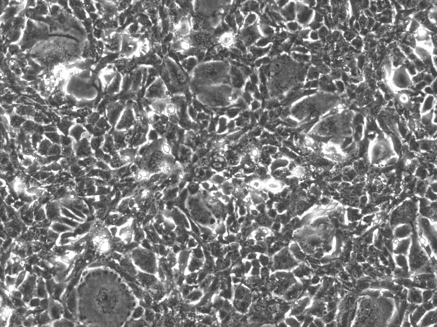 Hep-56.1D Cells