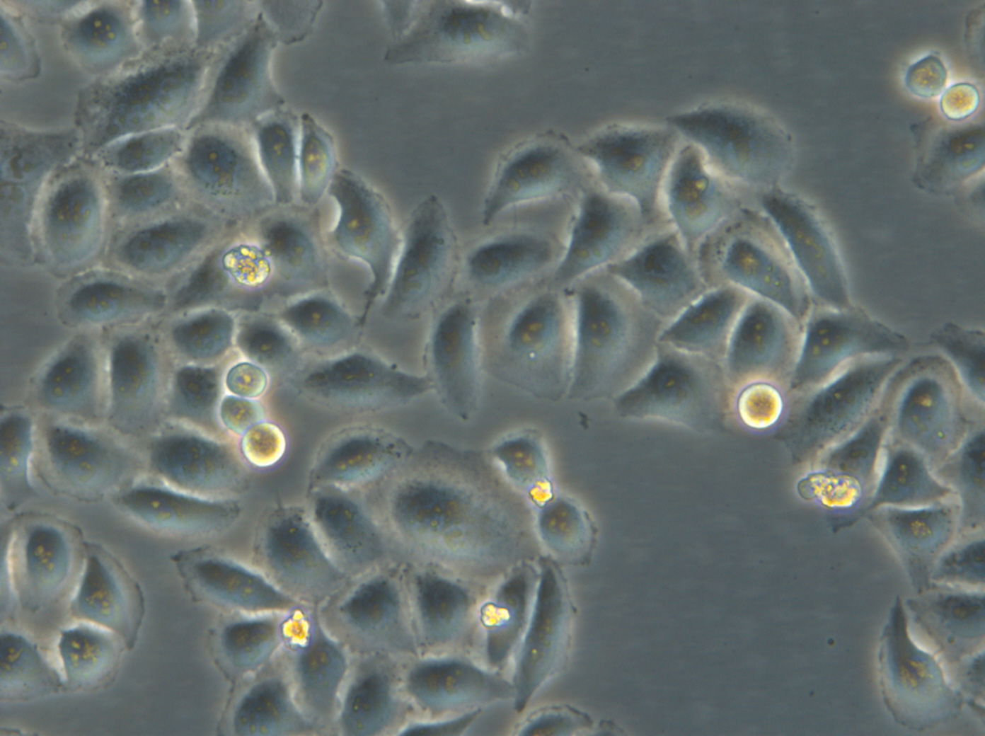 HK-ZFN-AURKB-mEGFP Cells